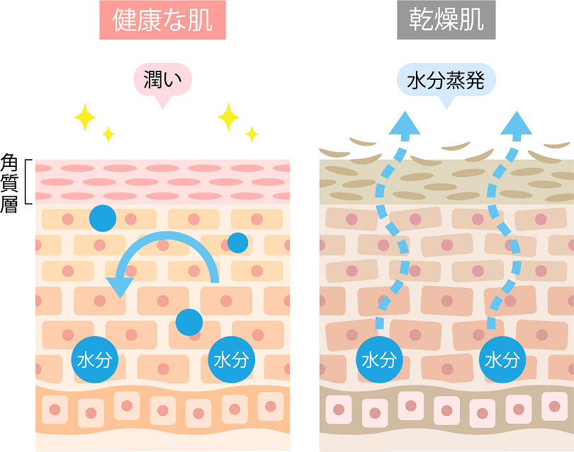 乾燥肌の予防と対策 必要な栄養素とは 薬剤師コラム